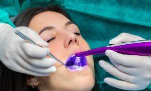 Can you clean your teeth if they are dark?