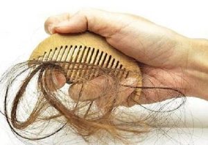 Can sunburn on the scalp cause hair loss? Why does the sun still cause hair loss